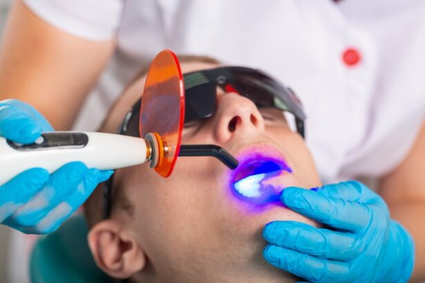 Cum funcționează tratamentul cariilor cu laser și de ce este mai confortabil pentru pacient